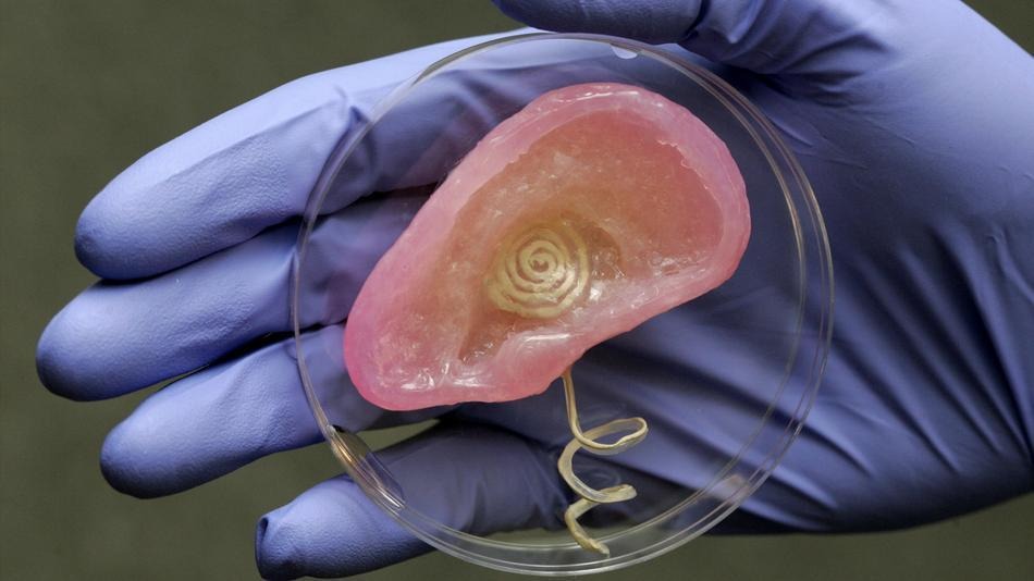 Bionic Ear Made From 3D Printing